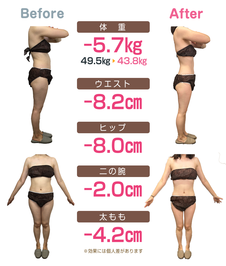 ビフォーアフター